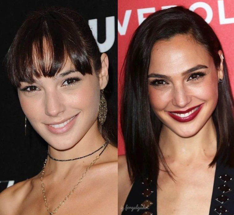 Gal Gadot Plastic Surgery: The Truth Behind Her Beauty