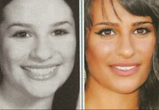 Lea Micheles Plastic Surgery 2