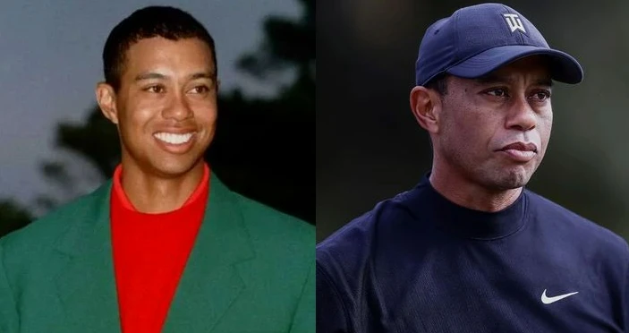 Tiger Woods Plastic Surgery 1