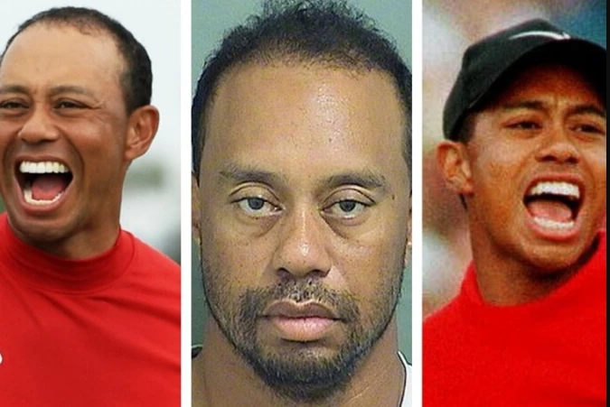 Tiger Woods Plastic Surgery