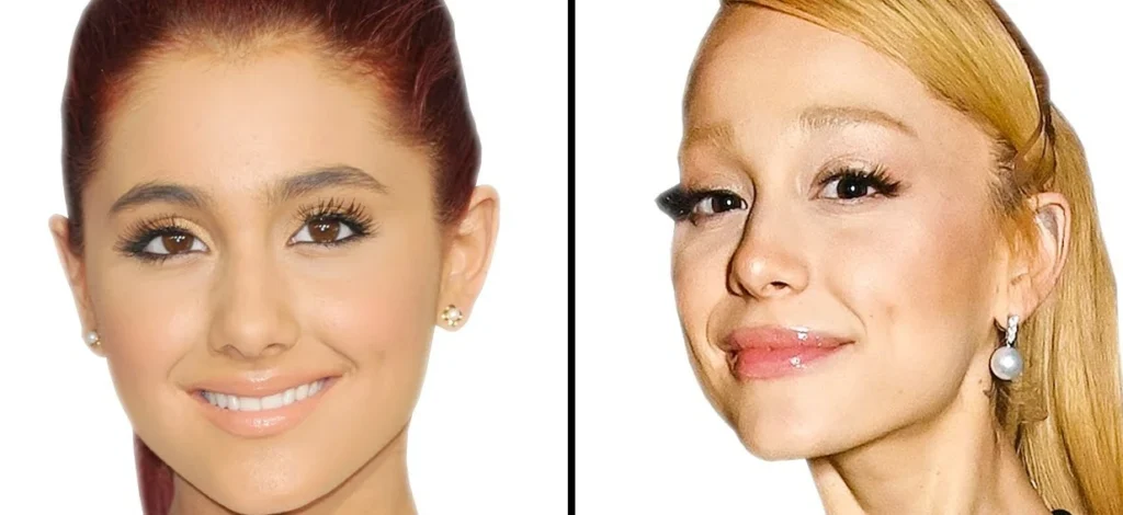 Ariana Grande’s Plastic Surgery