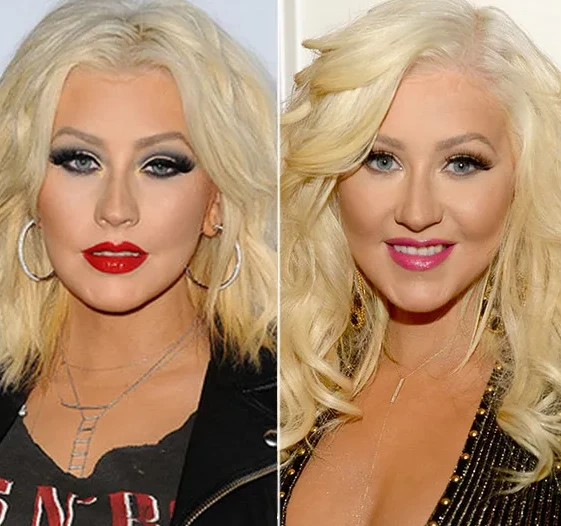 Christina Aguilera’s Plastic Surgery