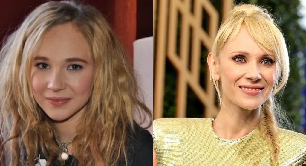 Juno Temple: Did She Have Plastic Surgery?
