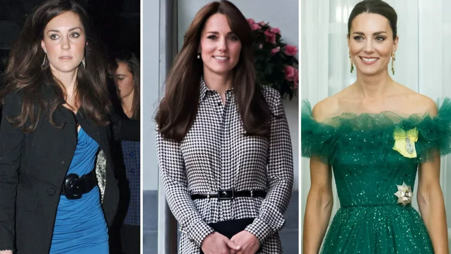 Kate Middletons Plastic Surgery 1