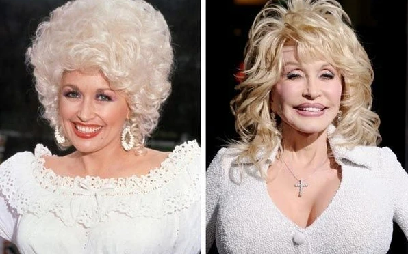 Dolly Parton Plastic Surgery 3