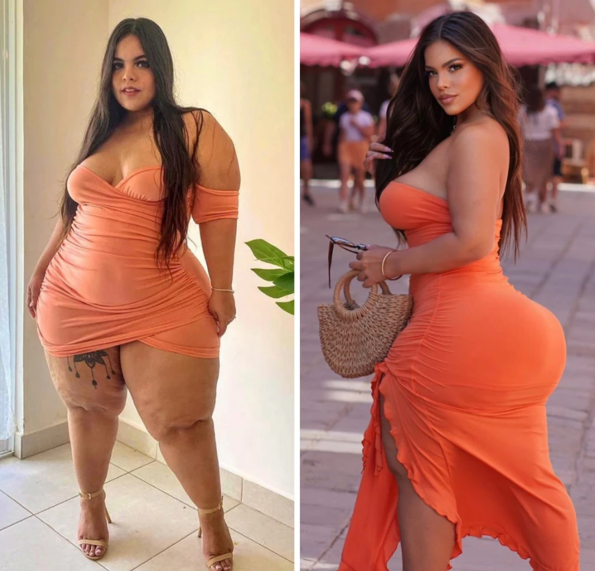 Gracie Bon Plastic Surgery Journey: From Insecurity to Confidence