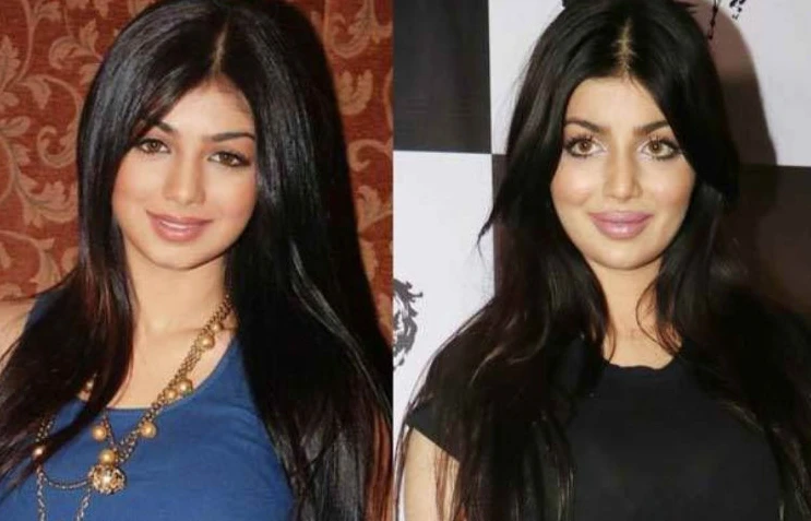 Ayesha Takia: The Bollywood Beauty Who Sparked Plastic Surgery Rumors