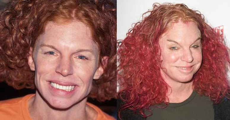 carrot top before surgery 1