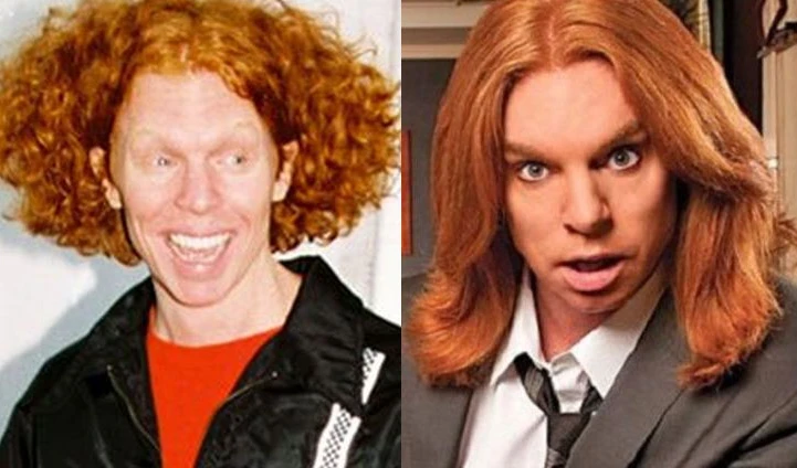 carrot top before surgery 2