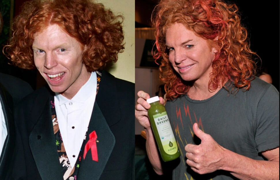 carrot top before surgery 3