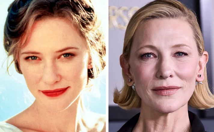 Cate Blanchett Plastic Surgery