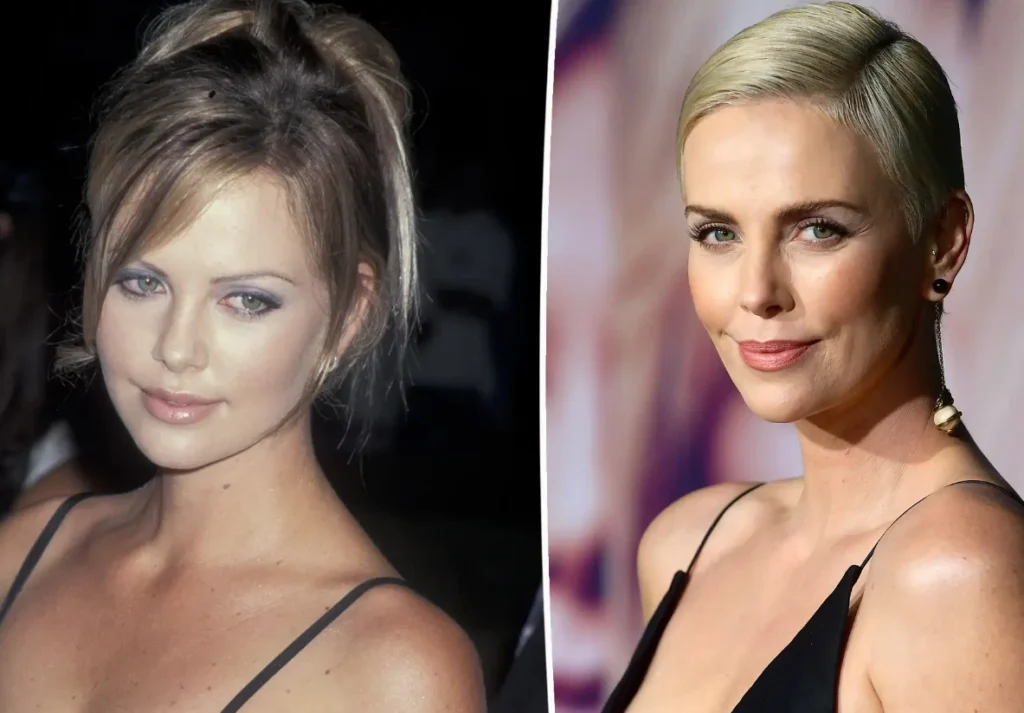 charlize theron plastic surgery 1