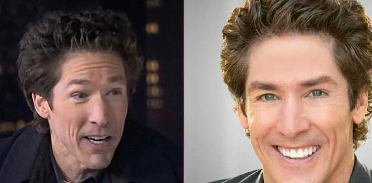 Joel Osteen’s Plastic Surgery The Truth Behind the Rumors